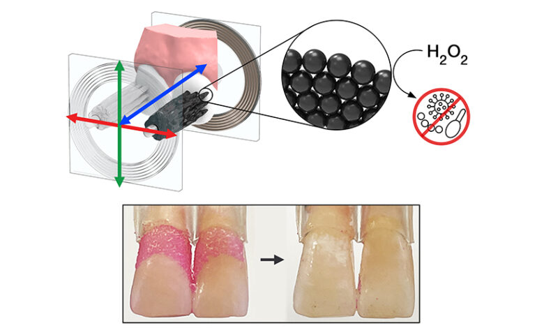 Shapeshifting Robots: A Revolution in Oral Care